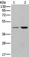 TBX1 Polyclonal Antibody – Figure 1 of 3