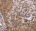 ING2 Polyclonal Antibody – Figure 1 of 3