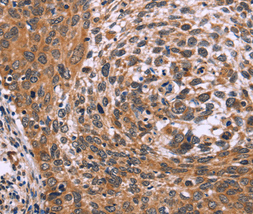 ING2 Polyclonal Antibody – Figure 1 of 3