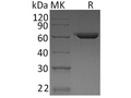 Recombinant Human Fibronectin/FN Protein – Figure 1 of 3
