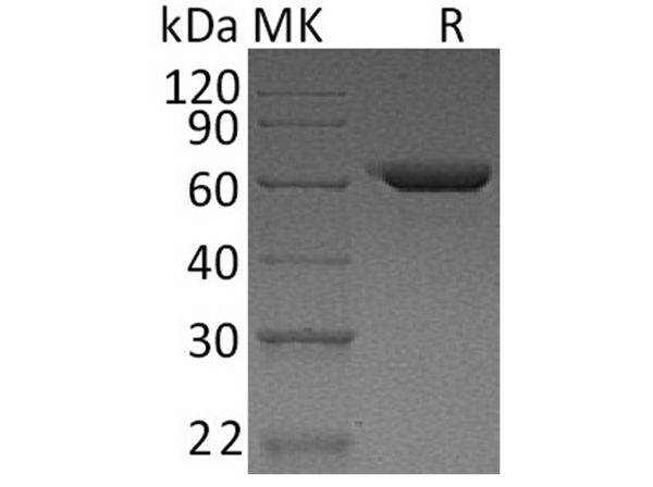 Recombinant Human Fibronectin/FN Protein – Figure 1 of 3