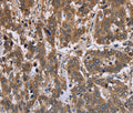 FBP2 Polyclonal Antibody – Figure 1 of 3