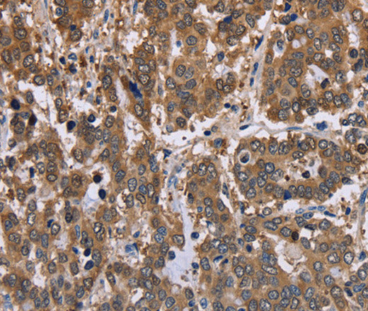 FBP2 Polyclonal Antibody – Figure 1 of 3