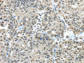 FUS Polyclonal Antibody – Figure 1 of 2