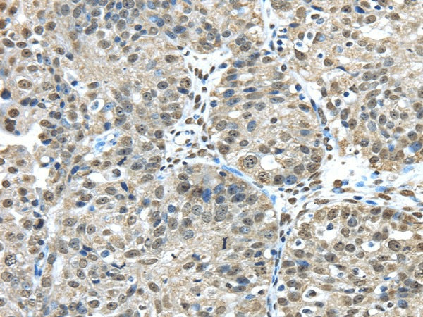 FUS Polyclonal Antibody – Figure 1 of 2