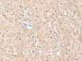 MLKL Polyclonal Antibody – Figure 1 of 3