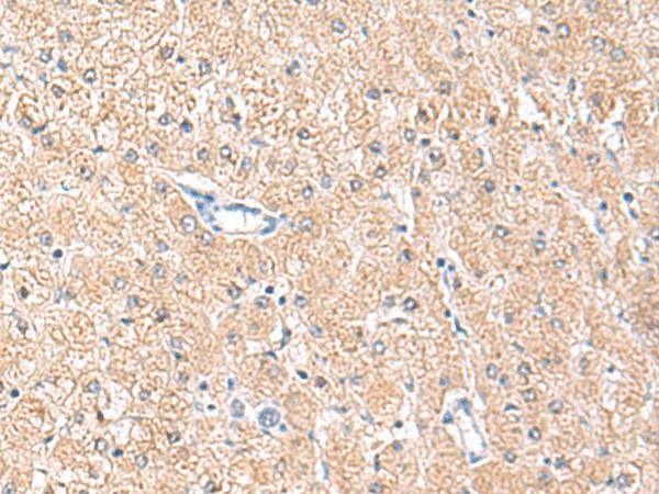 MLKL Polyclonal Antibody – Figure 1 of 3