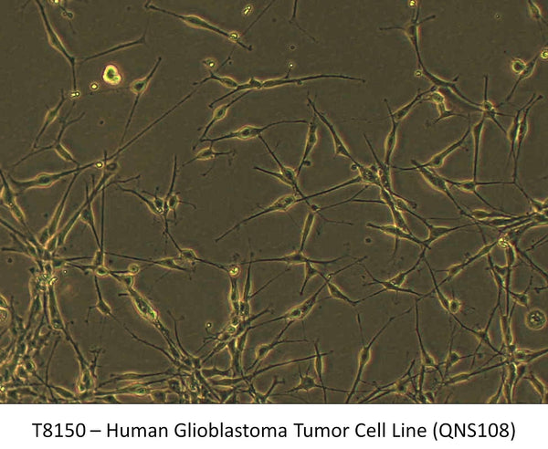 Human Glioblastoma Tumor Cell Line (QNS108) | Applied Biological Materials (abm)