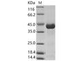 Recombinant CHIKV (strain SL-CK1) Envelope 2 Protein (His Tag) – Figure 1 of 2
