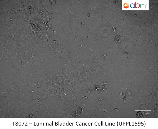 Luminal Bladder Cancer Cell Line (UPPL1595) | Applied Biological Materials (abm)