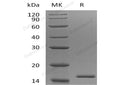 Recombinant Human EIF1B Protein (His Tag) – Figure 1 of 2