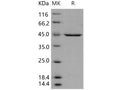 Recombinant Human PDK-1 Protein (His Tag) – Figure 1 of 2