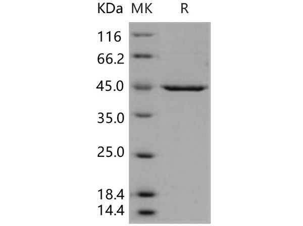 Recombinant Human PDK-1 Protein (His Tag) – Figure 1 of 2