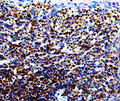 IL10RA Polyclonal Antibody – Figure 1 of 2