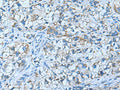 GUCA1A Polyclonal Antibody – Figure 1 of 3