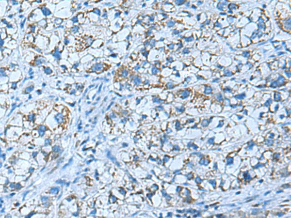 GUCA1A Polyclonal Antibody – Figure 1 of 3
