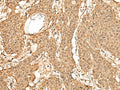 TIPRL Polyclonal Antibody – Figure 1 of 3