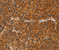 IKZF3 Polyclonal Antibody – Figure 1 of 3