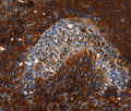 MSLN Polyclonal Antibody – Figure 1 of 3