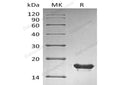 Recombinant Human SUMO2 Protein (His Tag) – Figure 1 of 2