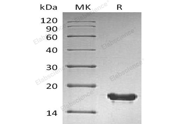 Recombinant Human SUMO2 Protein (His Tag) – Figure 1 of 2