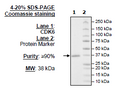 CDK6, His-Tag Recombinant – Figure 1 of 1