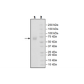 B7-1 (Woodchuck), Fc-fusion (Human), Avi-Tag, Biotin-labeled Recombinant – Figure 1 of 2