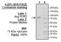 ROR2, Fc-Fusion (IgG1), Avi-Tag, Biotin-Labeled HiP™ Recombinant – Figure 1 of 2