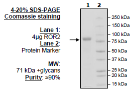 ROR2, Fc-Fusion (IgG1), Avi-Tag, Biotin-Labeled HiP™ Recombinant – Figure 1 of 2