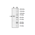 BTLA, Fc Fusion, Avi-Tag, Biotin-Labeled HiP™ Recombinant – Figure 1 of 3