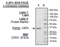 CDK4, FLAG-Tag Recombinant – Figure 1 of 1