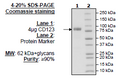 CD123, Fc-Fusion (IgG1) Avi-Tag Recombinant – Figure 1 of 2