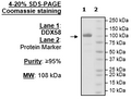 DDX58, FLAG-Tag Recombinant – Figure 1 of 3