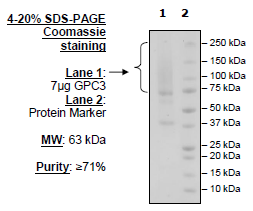 GPC3, Avi-His-Tagged, Biotin-Labeled Recombinant – Figure 1 of 2