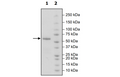 4-20% SDS-PAGE Coomassie Staining