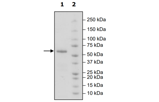 4-20% SDS-PAGE Coomassie Staining