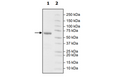4-20% SDS-PAGE Coomassie Staining