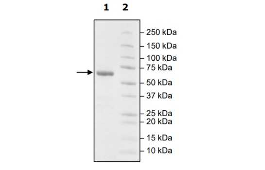 4-20% SDS-PAGE Coomassie Staining