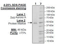 Aurora A Protein Kinase, His-Tag (HEK293-derived) Recombinant – Figure 1 of 2
