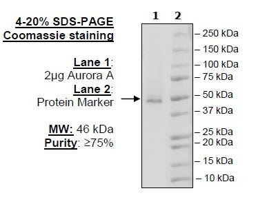 Aurora A Protein Kinase, His-Tag (HEK293-derived) Recombinant – Figure 1 of 2