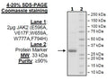 JAK2 (JH2 Domain) (E596A, V617F, W659A, W777A, F794H), His-Tag Recombinant – Figure 1 of 1