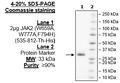 JAK2 (JH2 Domain) (W659A, W777A,F794H), His-Tag Recombinant – Figure 1 of 3