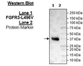FGFR3 (L496V), His-Tag Recombinant – Figure 1 of 2