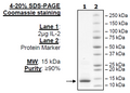 IL-2 (R58D, K63E, E81R, C146A) (Woodchuck) Recombinant – Figure 1 of 1