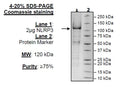 NLRP3 (NALP3), His-Flag-Tags Recombinant – Figure 1 of 1