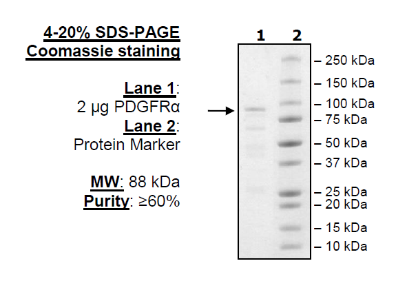 PDGFRα (D842I), GST-Tag Recombinant – Figure 1 of 1