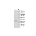 CD70 His-Avi-Tag, Biotin-Labeled Recombinant – Figure 1 of 2