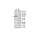 LILRA1, Avi-His Tag, Biotin-labeled Recombinant – Figure 1 of 1