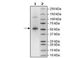 Cereblon, FLAG-Tag Recombinant – Figure 1 of 2