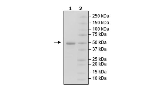 4-20% SDS-PAGE Coomassie Staining